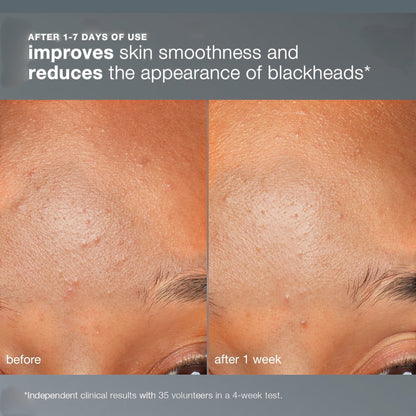 Dermalogica Daily Microfoliant Exfoliator
