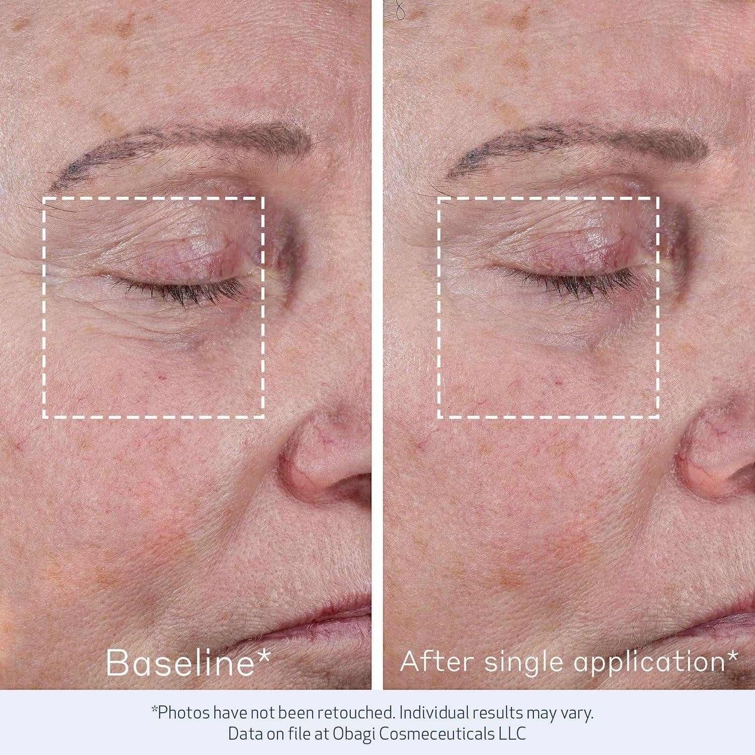 Obagi Elastiderm Advanced Filler Concentrate Wrinkle Smoothing Treatment 0.68 fl oz - DermLane