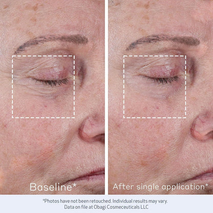 Obagi Elastiderm Advanced Filler Concentrate Wrinkle Smoothing Treatment 0.68 fl oz - DermLane